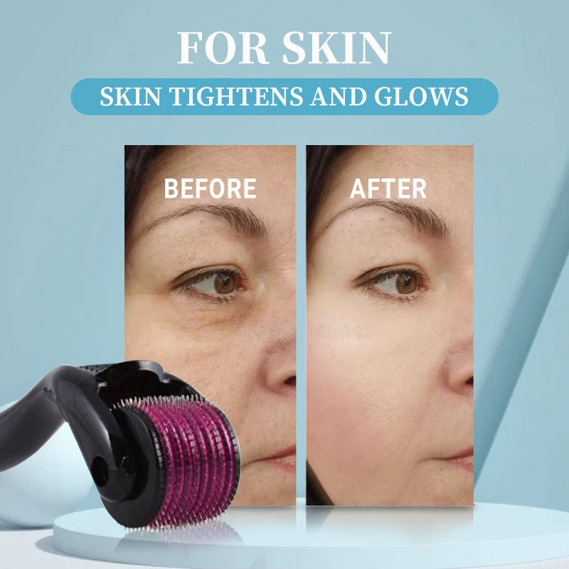 Titanium Derma Roller 540 Needles