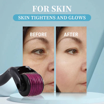 Titanium Derma Roller 540 Needles
