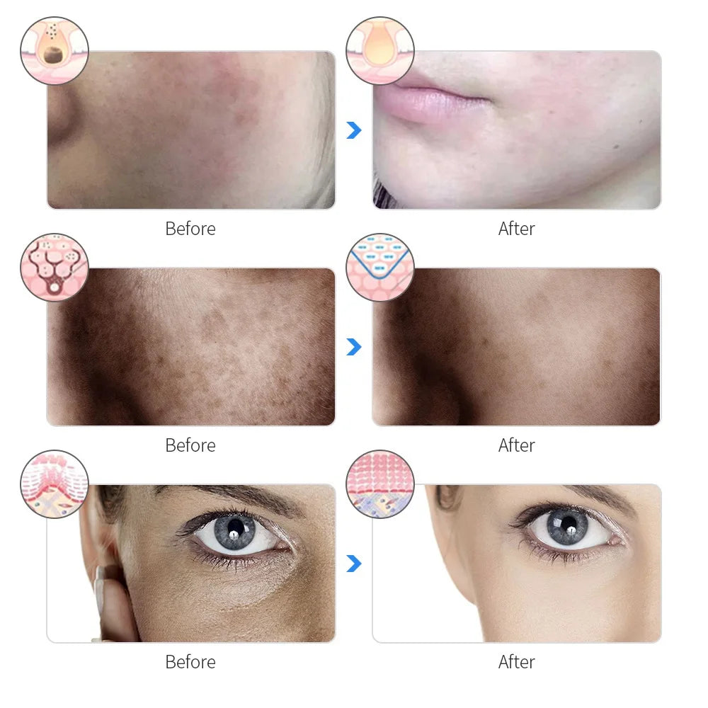LED Photon Therapy Face Mask (7 Colors)
