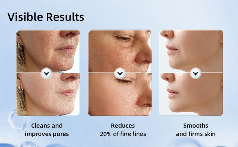 Instant Lift Neck & Face Device
