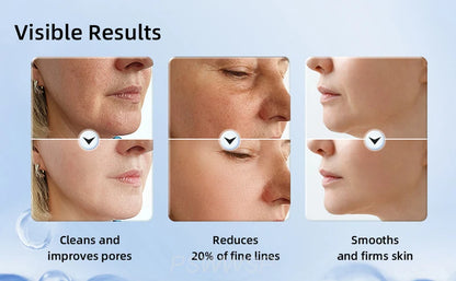 Instant Lift Neck & Face Device